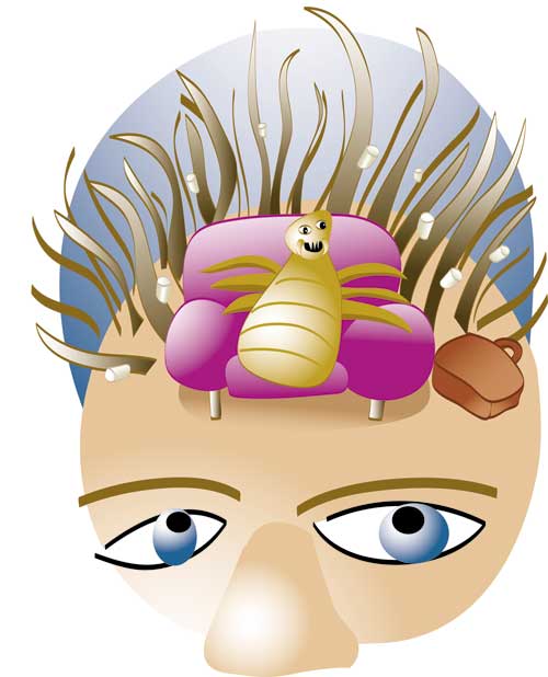 Lice invade a head of hair in this vector graphic by Joan McGuire